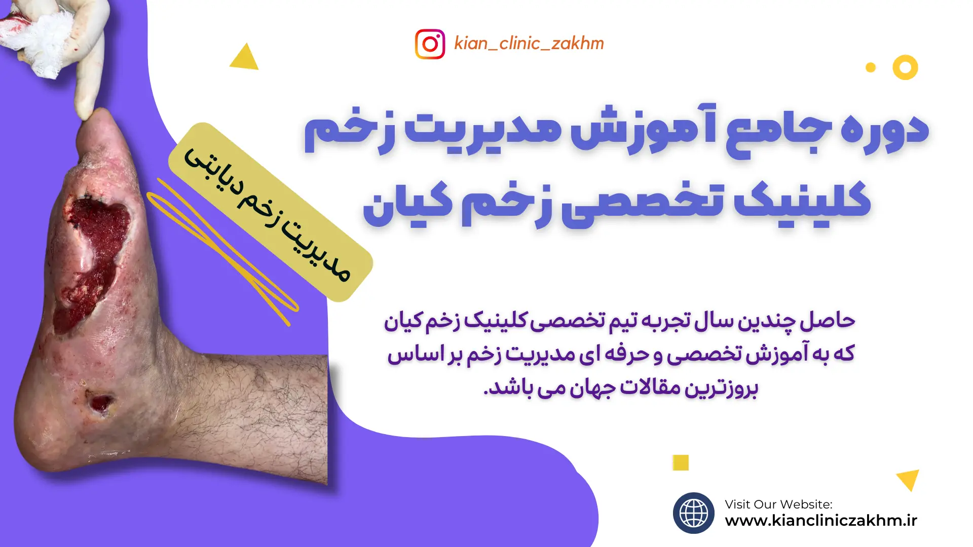 دوره جامع آموزش مدیریت زخم کلینیک تخصصی زخم کیان