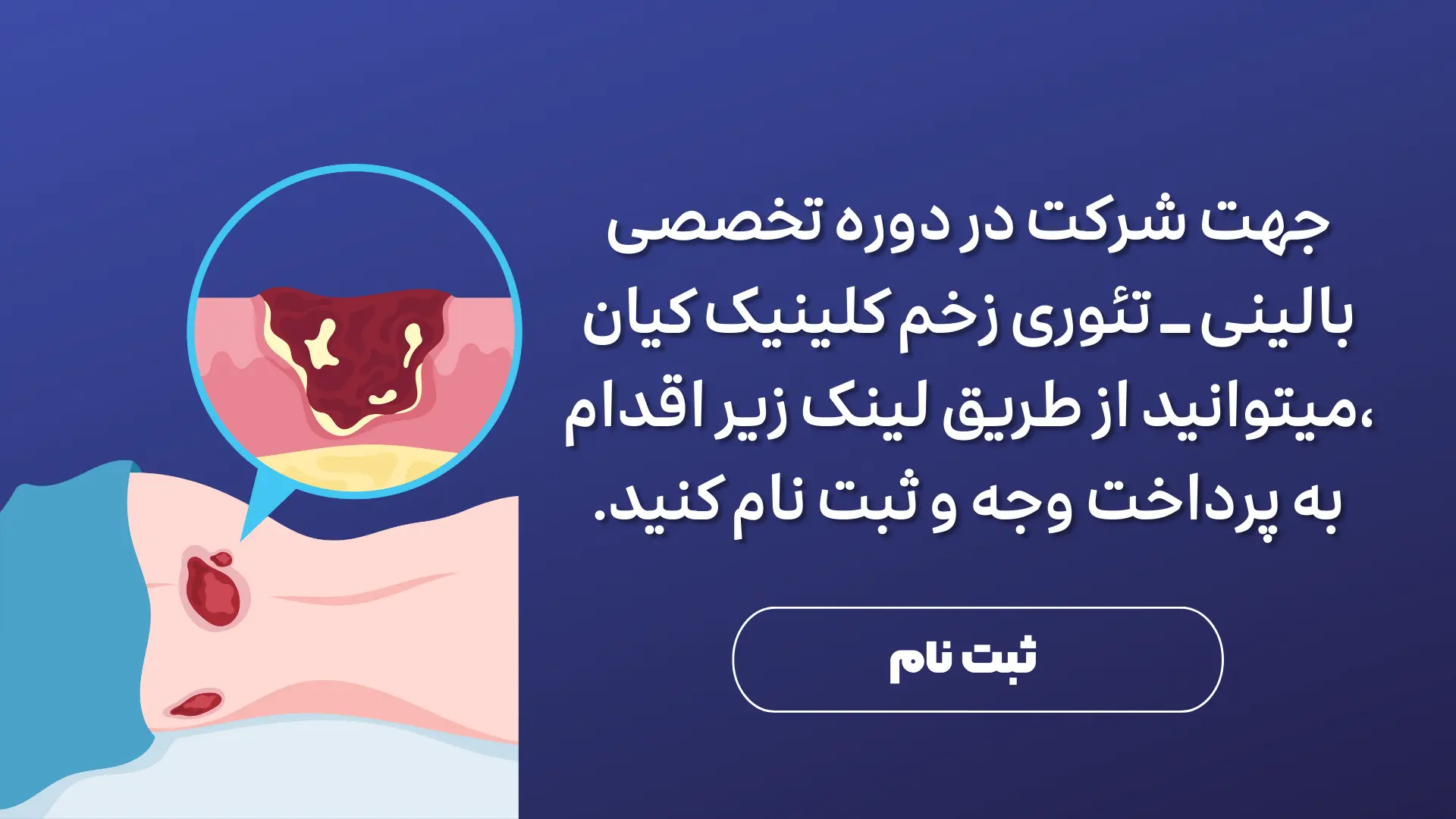 لینک ثبت نام در دوره تخصصی بالینی تئوری زخم کلینیک کیان