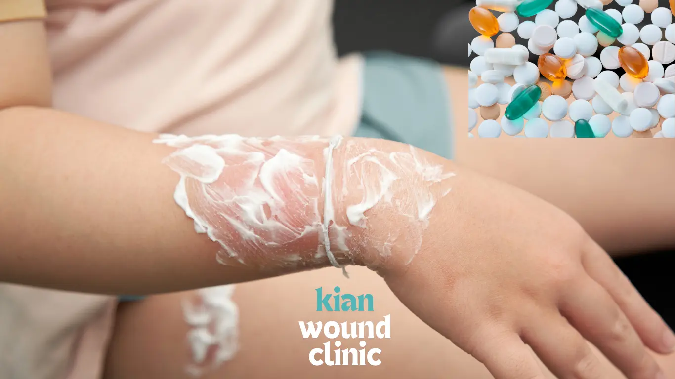 مشاوره درباره انتخاب قرص چرک خشک کن برای زخمس سوختگی - کلینیک زخم کیا